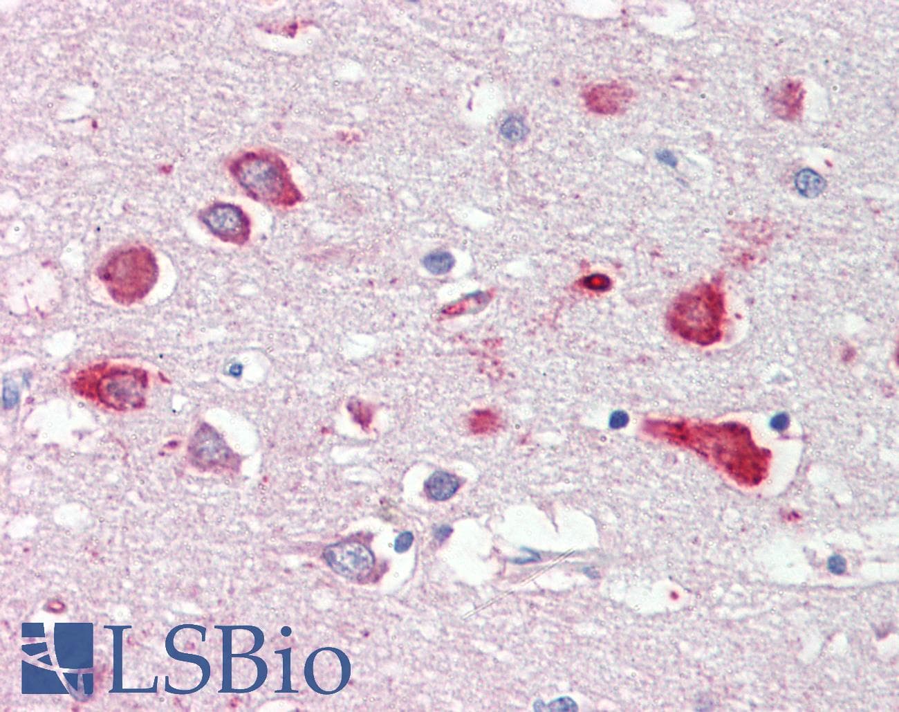 IHC-plus™ Polyclonal Goat anti-Human OSBPL9 Antibody (aa735-746, IHC)