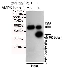 PRKAB1 / AMPK Beta 1 Antibody