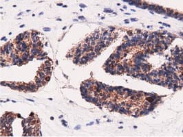 AK5 / Adenylate Kinase 5 Antibody (clone OTI2F9)