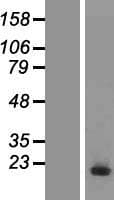 UBE2D3 / UBCH5C Protein (Over-Expression Lysate Myc-DDK (Flag))
