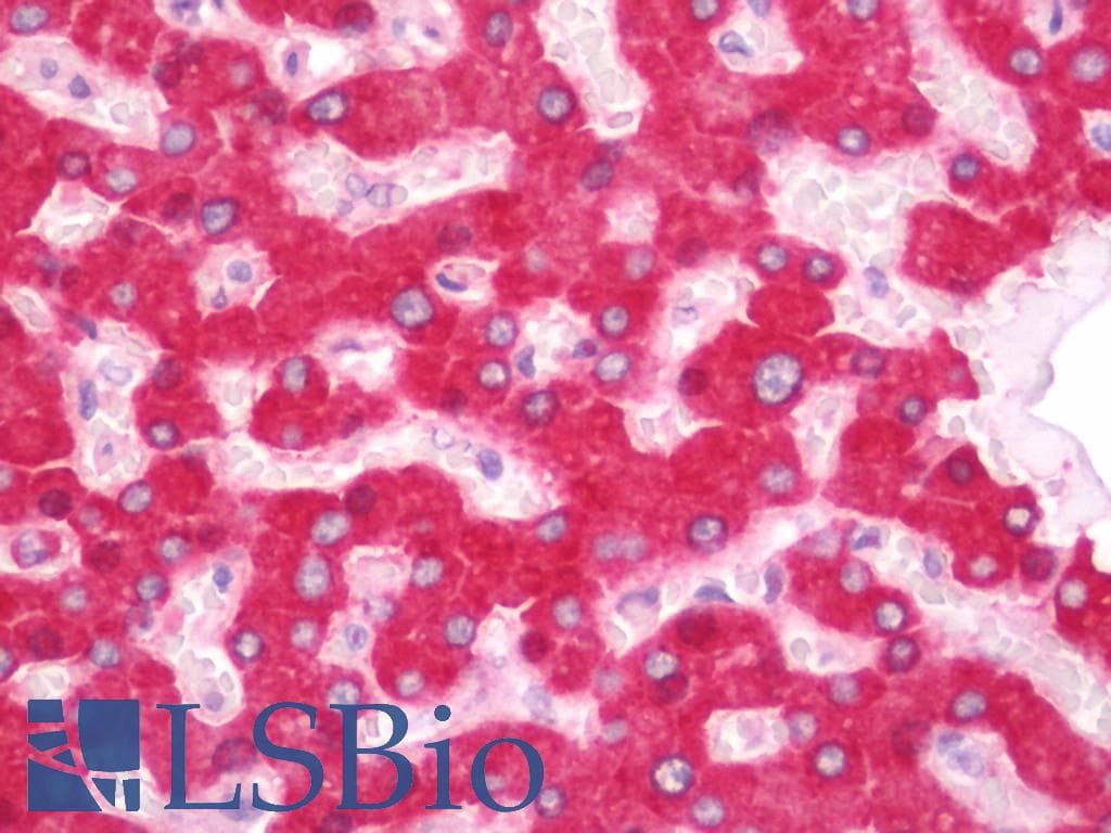 IHC-plus™ Polyclonal Rabbit anti-Human MGST1 Antibody (aa42-91, IHC, WB)