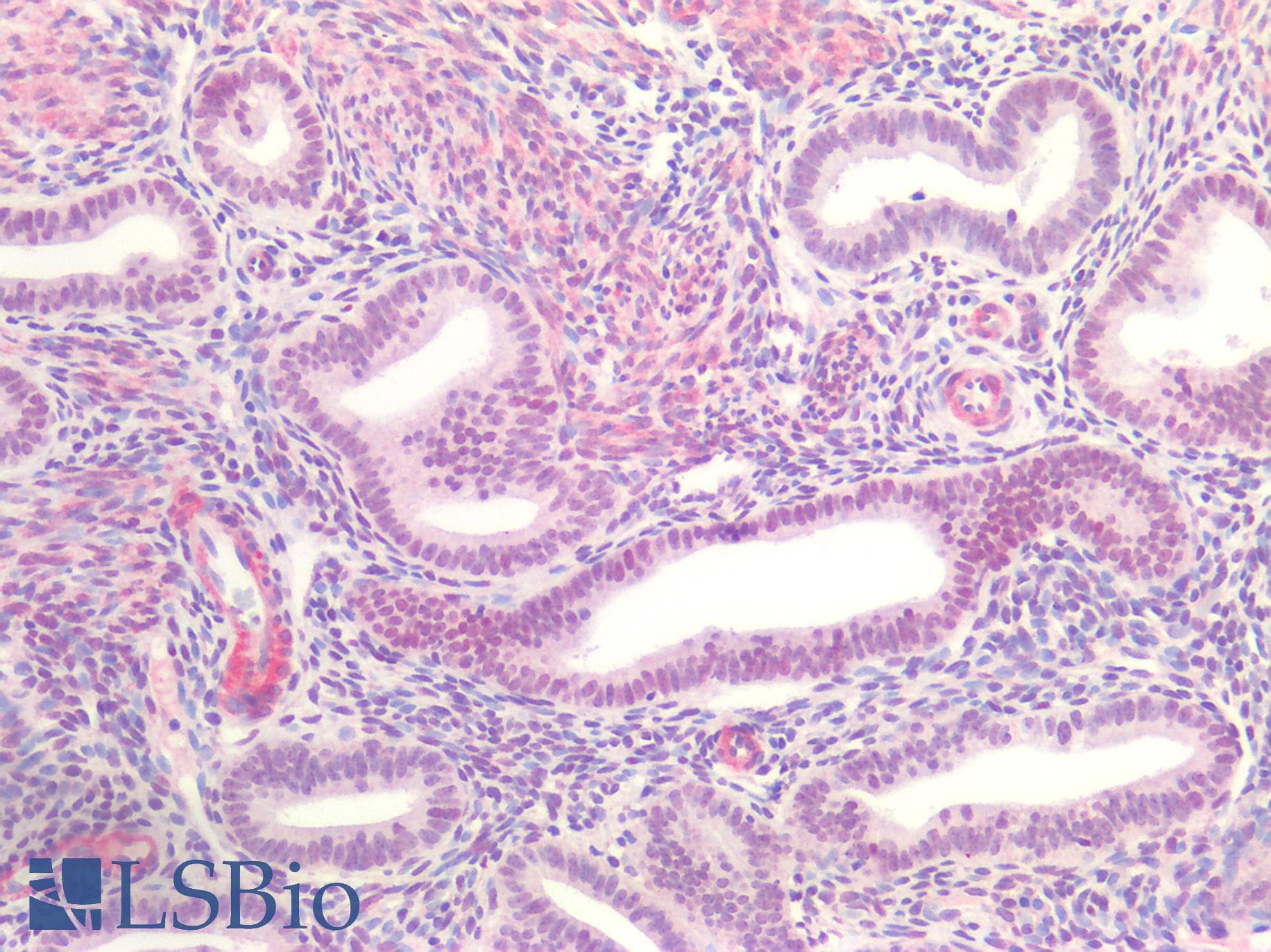 PathPlus™ ER Alpha / Estrogen Receptor Antibody