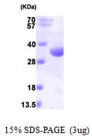 Human RCD1 / RQCD1 Protein (Recombinant His)