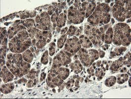MME / CD10 Antibody (clone OTI3D11)