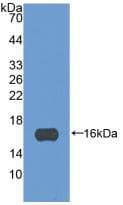 POSTN / Periostin Antibody (aa97-230)