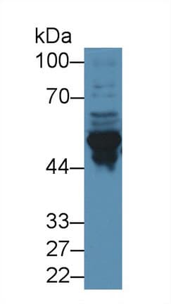 GFAP Antibody (aa70-374, FITC)