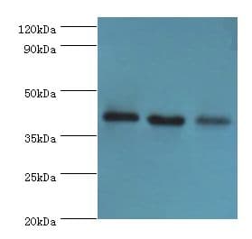 Polyclonal Rabbit anti-Human GPRC5A / RAI3 Antibody (aa258-357, IHC, WB)