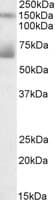 MSLN / Mesothelin Antibody (aa302-314)