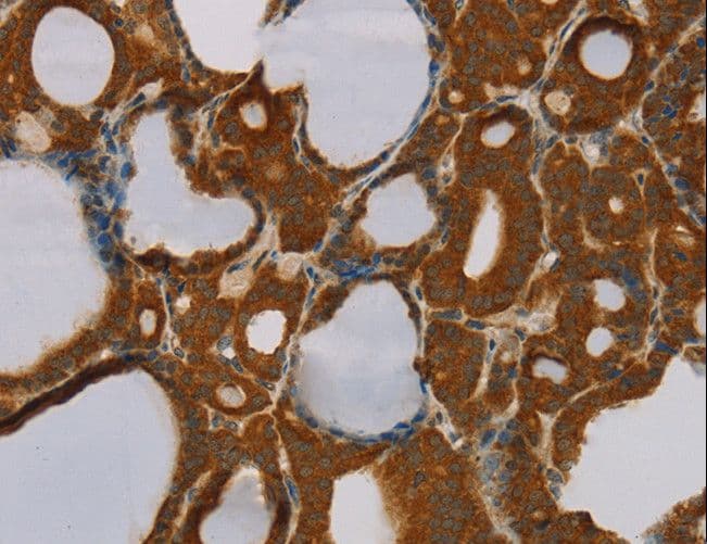 Polyclonal Rabbit anti-Human PARP3 Antibody (IHC)