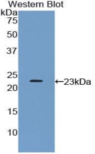PTPRN / IA-2 Antibody (aa368-575, Biotin)
