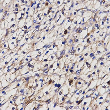 BCHE / Cholinesterase Antibody