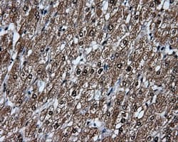 Monoclonal Mouse anti-Human TLDC1 / KIAA1609 Antibody (clone OTI5D9, IHC, IF, WB)