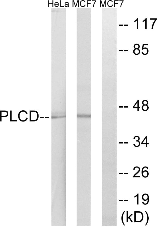 AGPAT4 Antibody (aa151-200)