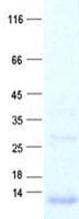Human TIMM9 Protein (Recombinant His, N-Terminal)