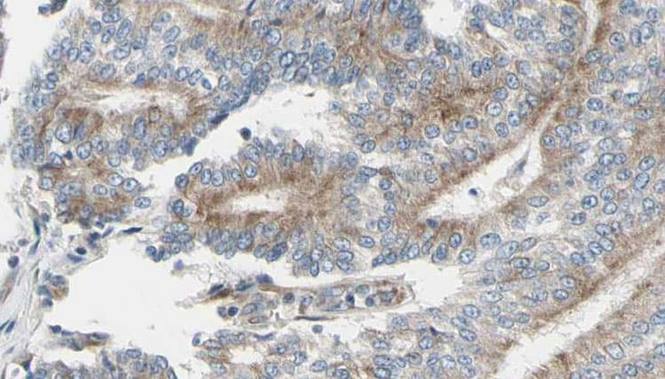 ACTA1 / Skeletal Muscle Actin Antibody