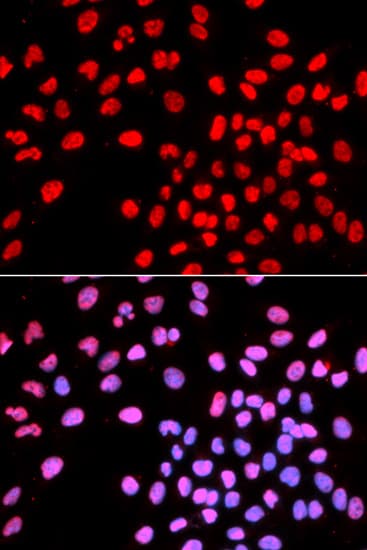 IHC-plus™ Polyclonal Rabbit anti-Human IKZF1 / IKAROS Antibody (IHC, IF, WB)
