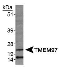 MAC30 / TMEM97 Antibody (aa105-155)