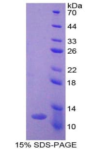 Human Ghrelin Protein (Recombinant His)