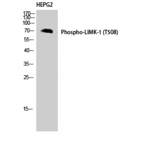 LIMK1 / LIMK Antibody (440-520 aa)