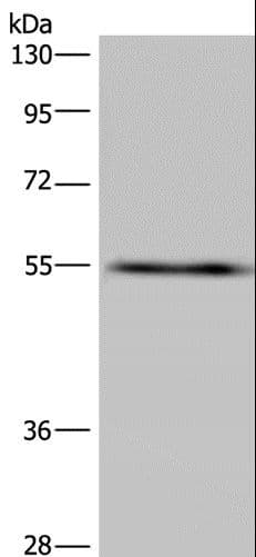 Polyclonal Rabbit anti-Human IMPDH2 Antibody (IHC, WB)