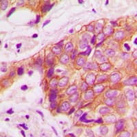Polyclonal Rabbit anti-Human ADD1 / Adducin Alpha Antibody (phospho-Thr445, IHC, WB)