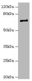HNRPM / HNRNPM Antibody (aa491-730)
