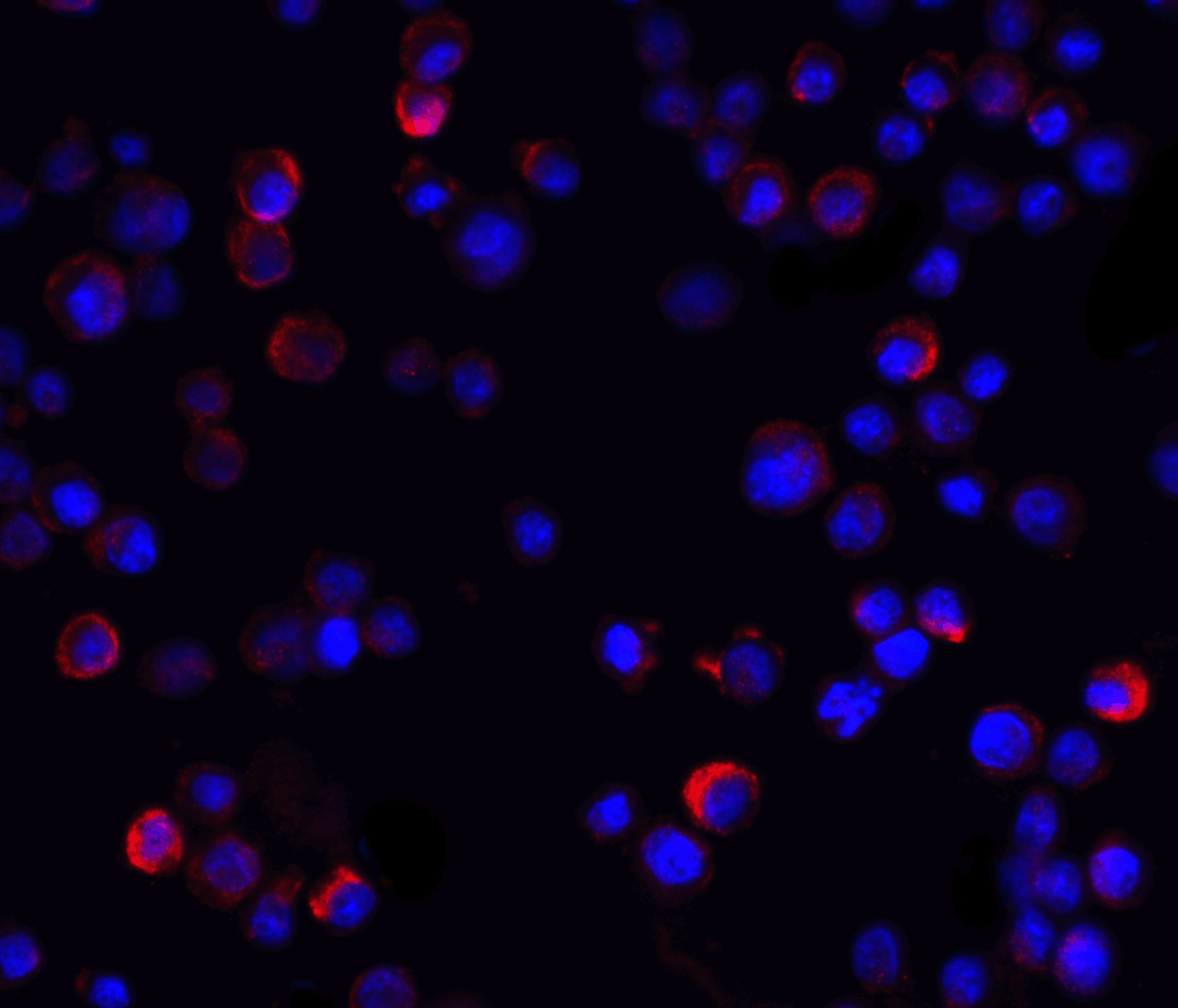 IHC-plus™ IKBKG / NEMO / IKK Gamma Antibody
