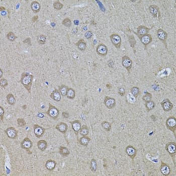 PHF1 Antibody