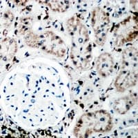 Polyclonal Rabbit anti-Human PYCR1 Antibody (IHC, WB)