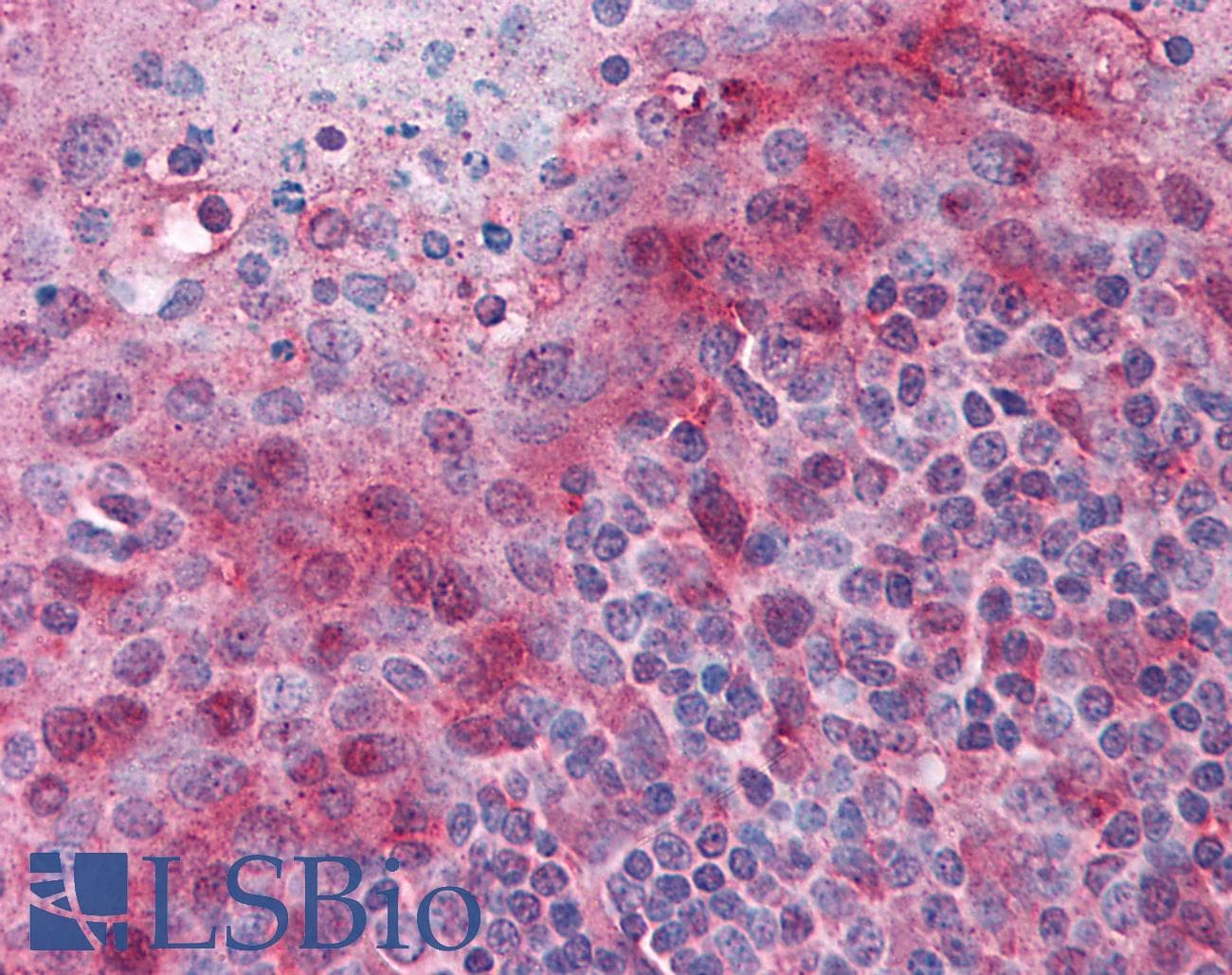 IHC-plus™ PYCARD / ASC / TMS1 Antibody (aa182-195)