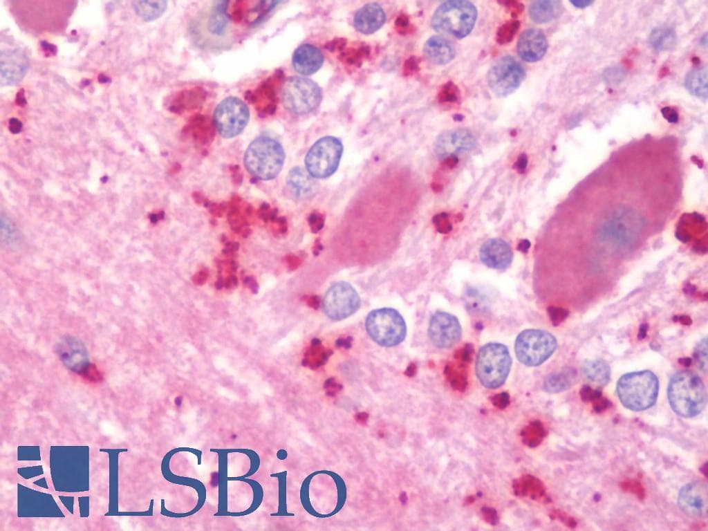 PPP3CA / CCN1 / Calcineurin A Antibody (aa364-283, Biotin)