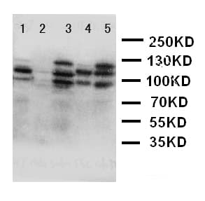 DSG2 / Desmoglein 2 Antibody (aa1104-1118)