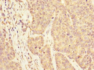 KLHL13 Antibody
