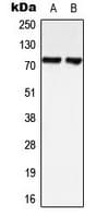 LIMK1 + LIMK2 Antibody (C-Terminus)