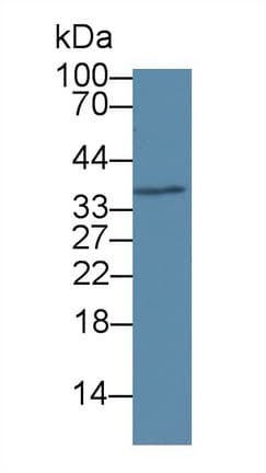 RNASEH2A Antibody