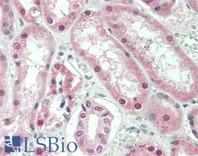 IHC-plus™ Polyclonal Rabbit anti-Human COPS2 / TRIP15 / ALIEN Antibody (aa1-50, IHC, WB)