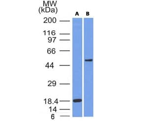 Monoclonal Mouse anti-Human SOX10 Antibody (clone SOX10/991, Ready-to-Use, IHC)