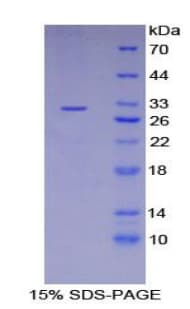 Human LIMS1 / PINCH Protein (Recombinant His-T7)