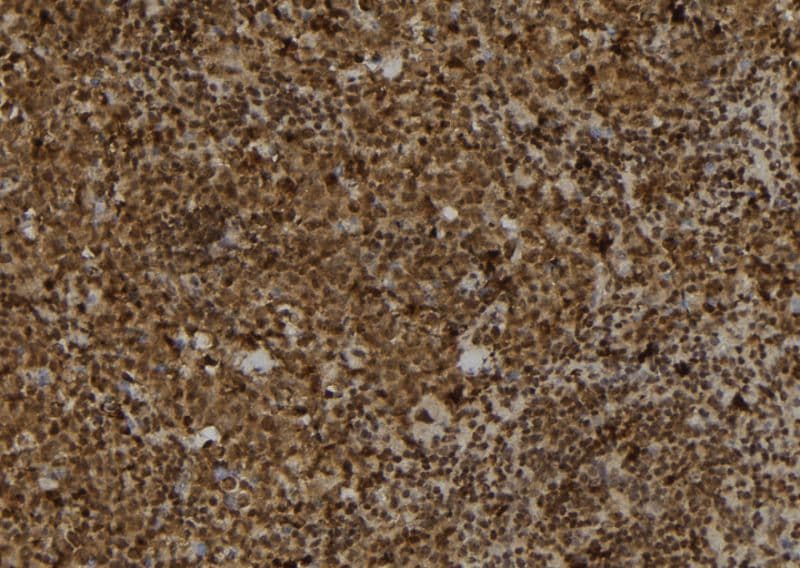 Polyclonal Rabbit anti-Human TRAM2 Antibody (IHC, WB)