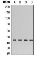 PTX3 / Pentraxin 3 Antibody (N-Terminus)