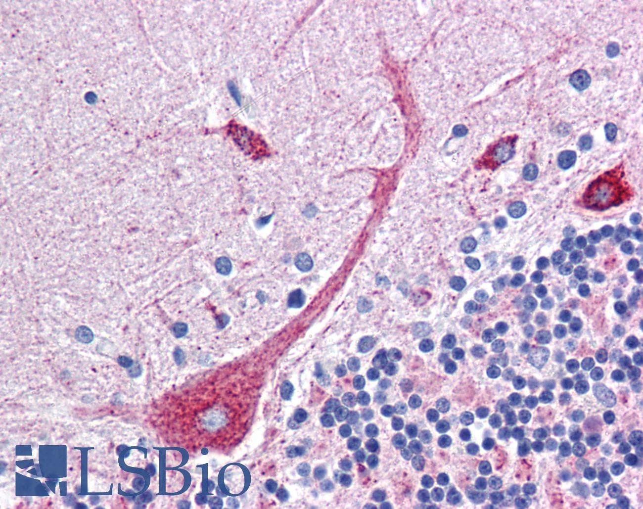 IHC-plus™ Polyclonal Rabbit anti-Human PLEKHO1 / CKIP-1 Antibody (IHC, WB)