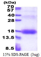 Human ZNRD1 Protein (Recombinant His)