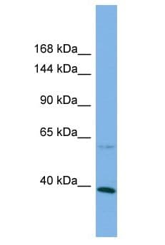 KANK1 Antibody (aa302-351)