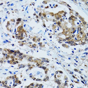 TOPBP1 Antibody