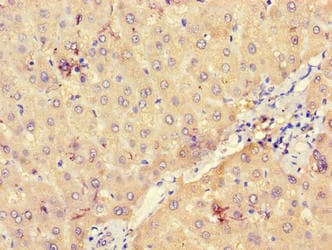 UGP2 Antibody