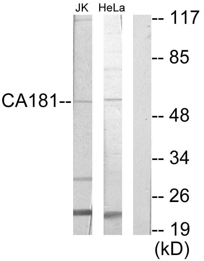 ZNHIT6 / C1orf181 Antibody