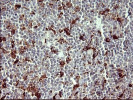 MMP13 Antibody (aa104-471, clone OTI2D11)