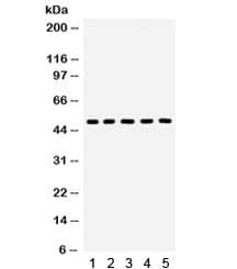 Polyclonal Rabbit anti-Human AQP2 / Aquaporin 2 Antibody (IHC, WB)