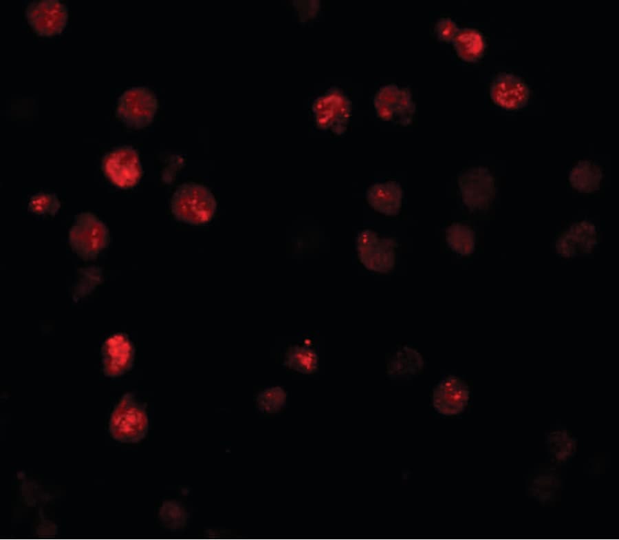 IHC-plus™ ATP11A Antibody