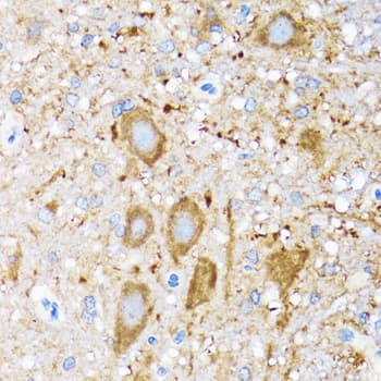 Polyclonal Rabbit anti-Human HSPH1 / HSP105 Antibody (IHC, WB)